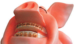 Скайсы на зубы: цены, фото и отзывы, установка страз на зубы