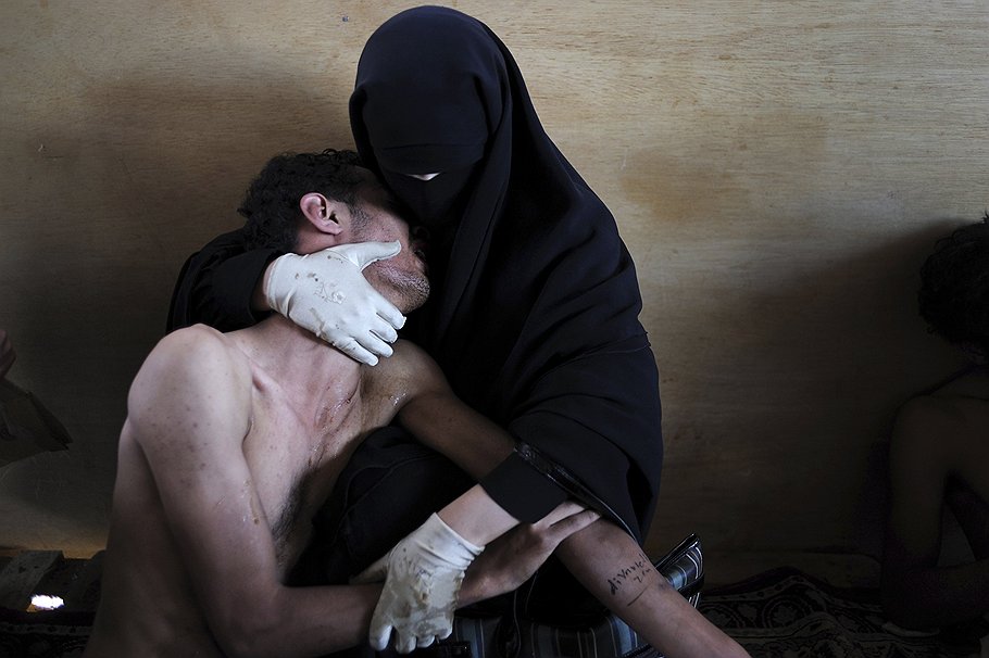 Главный приз получил снимок жительницы Йемена, держащей своего раненого родственника. Автор фото: Самуэль Аранда, Испания 
