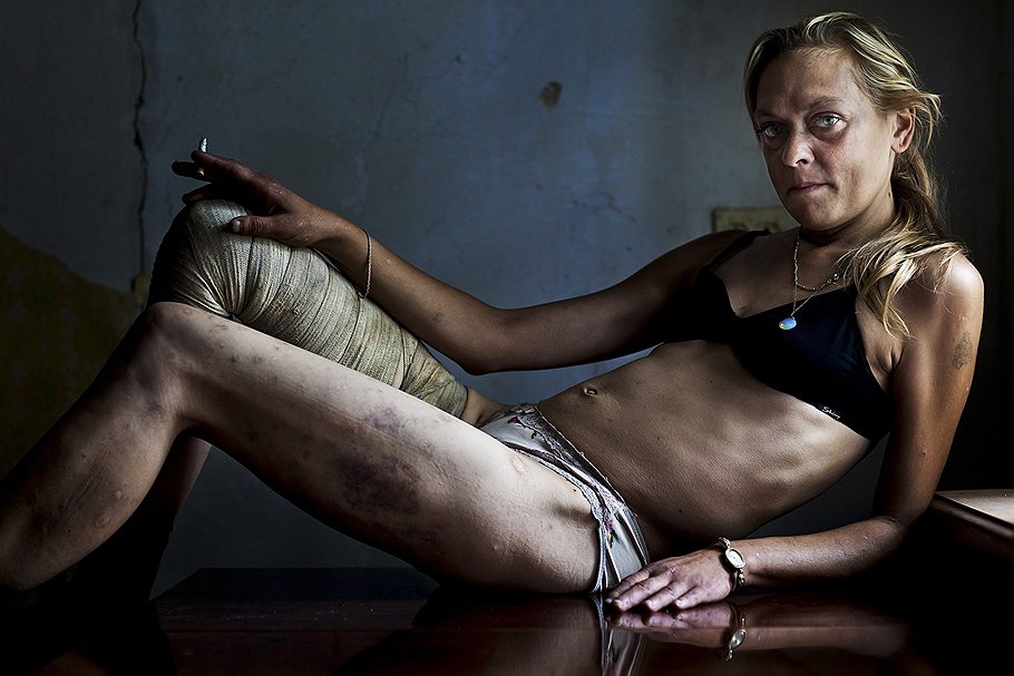 Номинация &quot;Современные проблемы&quot;. Снимок проститутки, страдающей наркозависимостью. Автор фото: Брент Стиртон, Южная Африка