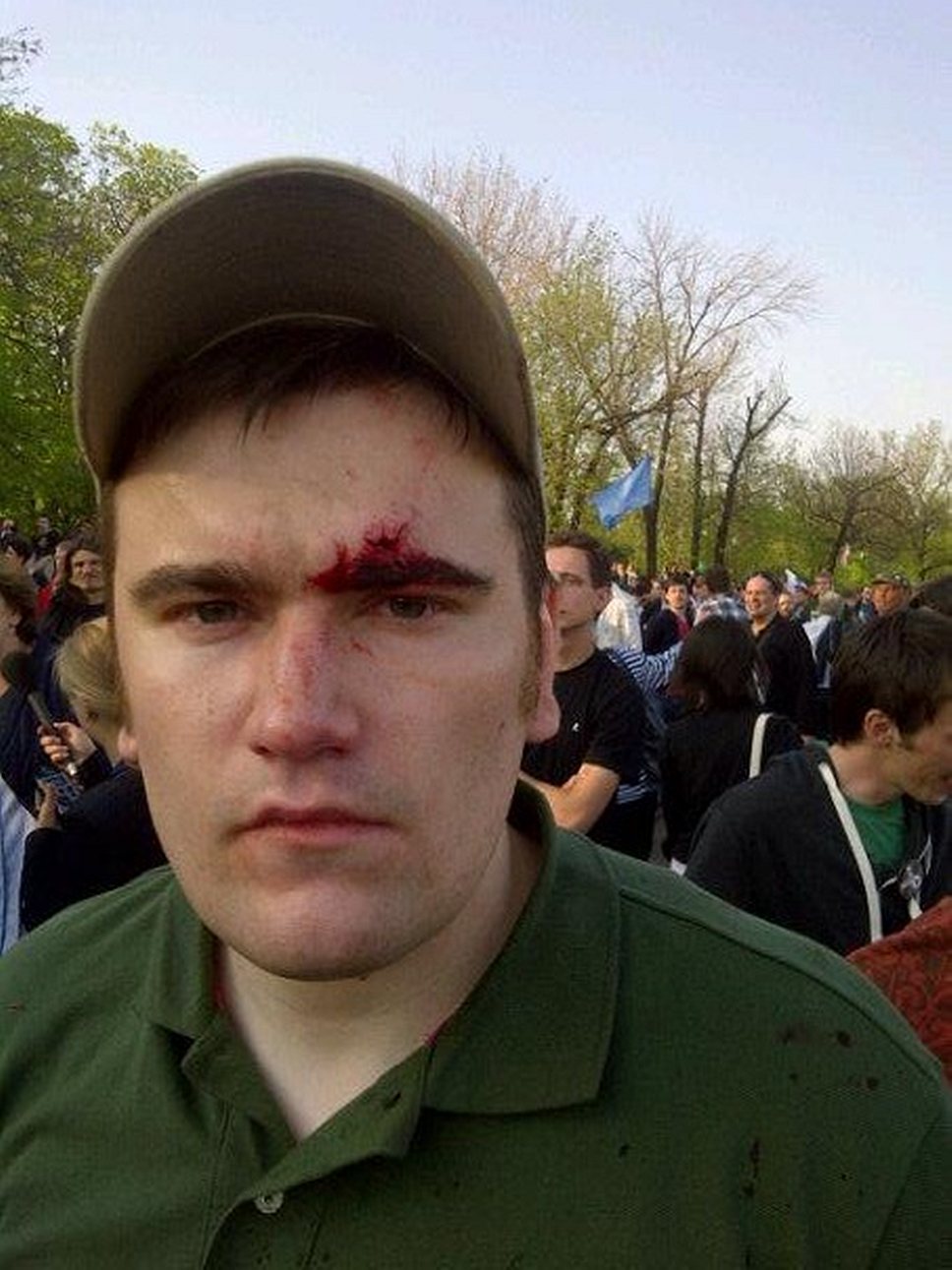 Алексей Гаскаров, избитый на «Марше миллионов» 6 мая