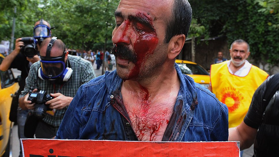 Турецкий рабочий, раненный во время демонстрации в Анкаре  