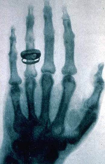 1895 год. В процессе экспериментов с электричеством Вильгельм Рентген открыл излучение, названное им X-лучами. Впоследствии оно получило название рентгеновское в честь ученого 