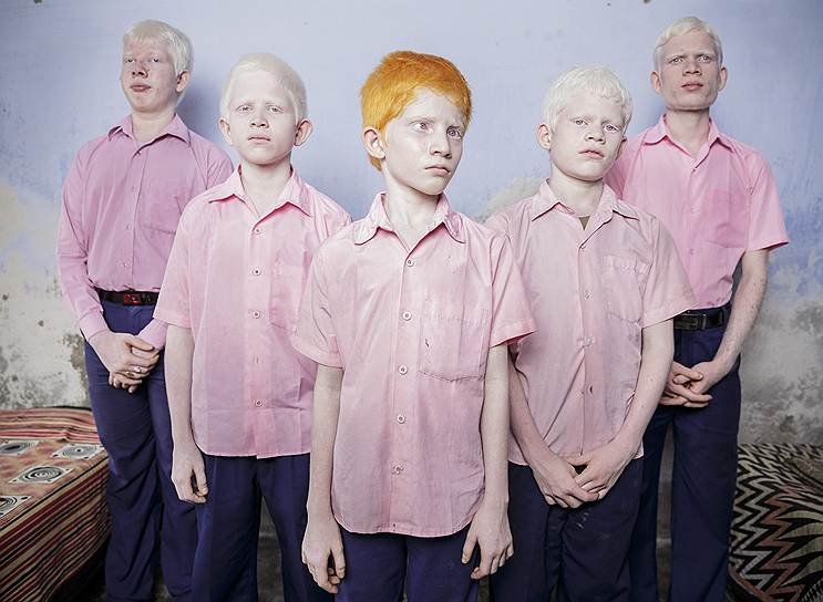 Брент Стиртон (Южная Африка, Getty Images), «Слепые мальчики-альбиносы»  