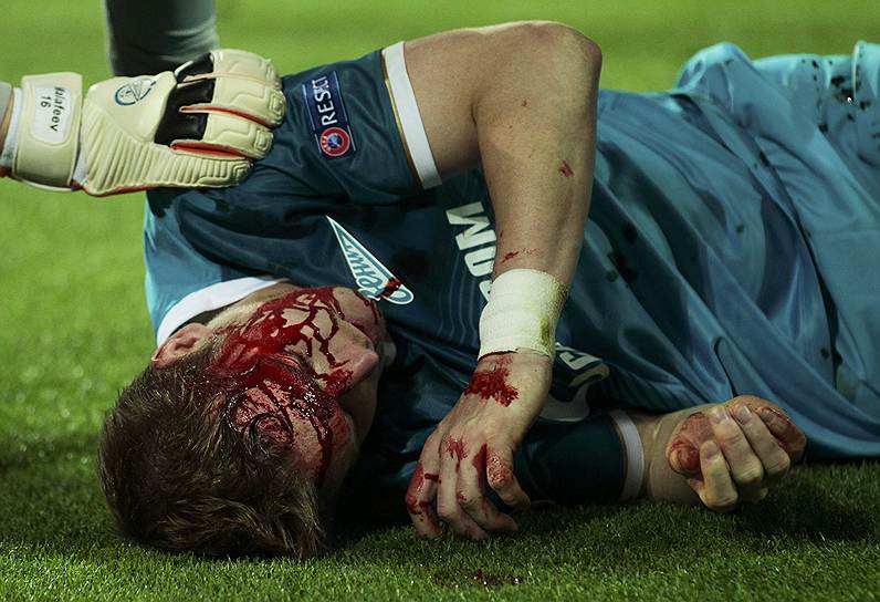Защитник «Зенита» Томаш Губочан получил травму в матче с «Боруссией» в Дортмунде