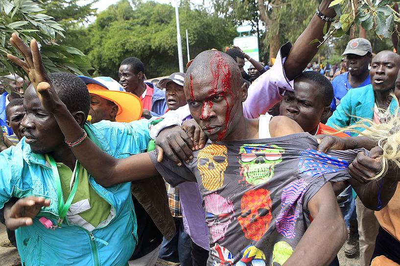 Сторонник оппозиции в Кении, получивший ранение головы в результате столкновений с местной полицией перед празднованием «Дня Саба-Саба» в Найроби