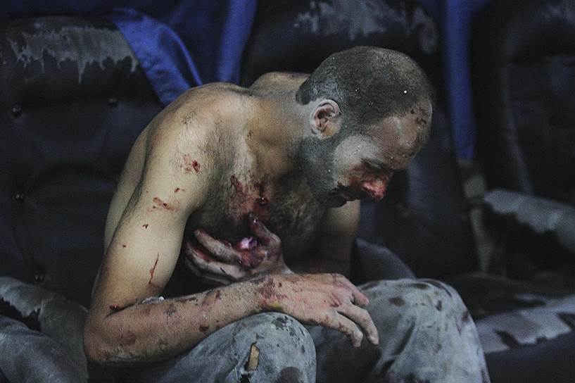 Мужчина, раненный во время авиаудара по одному из районов Дамаска, ожидает помощи в полевом госпитале