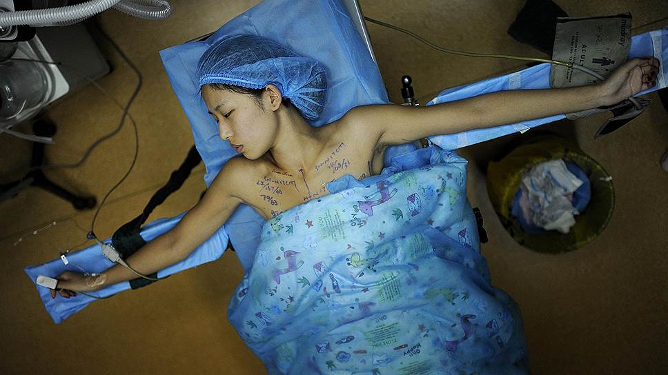 21-летняя китаянка после пластической операции на груди 