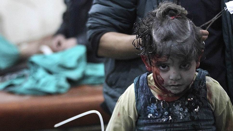 Дума, Сирия. Раненая девочка ждет лечения в полевом госпитале после авиаудара, который, как заявила оппозиция, был произведен военными силами, поддерживающими президента Сирии Башара Асада