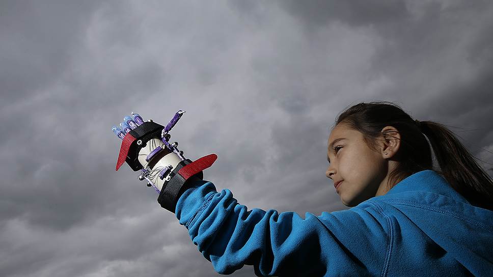 Школьница из Иллинойса (США) Кайли Викер родилась без пальцев левой руки. Но в 2014 году ее школьные друзья нашли схему протеза в интернете и, благодаря 3D-принтеру, буквально распечатали девочке новую руку 
