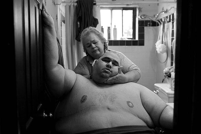 «Другая жизнь: жертвы ожирения» — серия фотографий о Гекторе Гарсии-младшем, страдающим ожирением, и его матери Елене. В 2010 году он начал худеть, осознав, что его жизнь находится в опасности. Автор — Лиза Крантц (США)