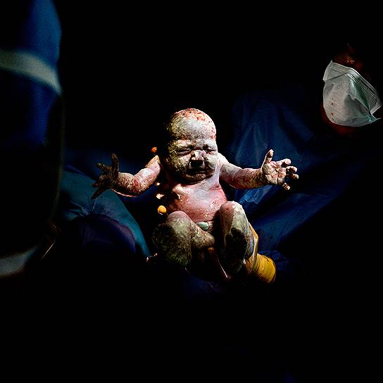 «Цезарь»  — серия фотографий о детях, рожденных с помощью кесарева сечения. Автор — Кристиан Бертелот (Christian Berthelot)
