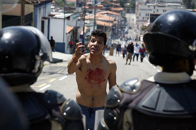 Сан-Кристобаль, Венесуэла. Мужчина с кровью на груди во время акций протеста после гибели 14-летнего Клуйвера Роа в ходе столкновений с полицией
