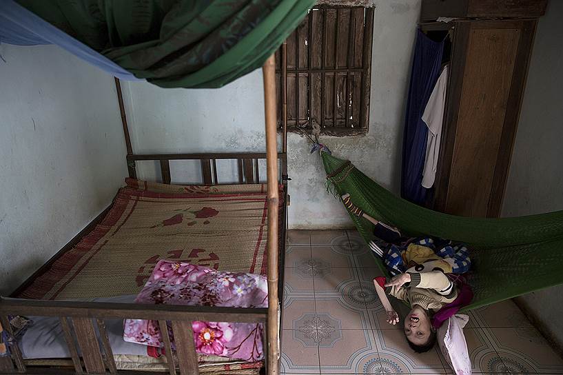 Как правило, болезни связаны с постоянной болью, но большинство вьетнамцев не могут позволить себе обезболивание и вынуждены терпеть постоянные мучения
&lt;br>На фото: Фан Ван Лам 
