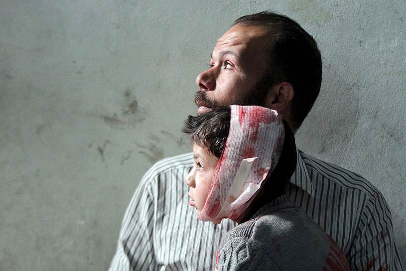 Дамаск, Сирия. Пострадавший после артиллерийских ударов мальчик вместе со своим отцом