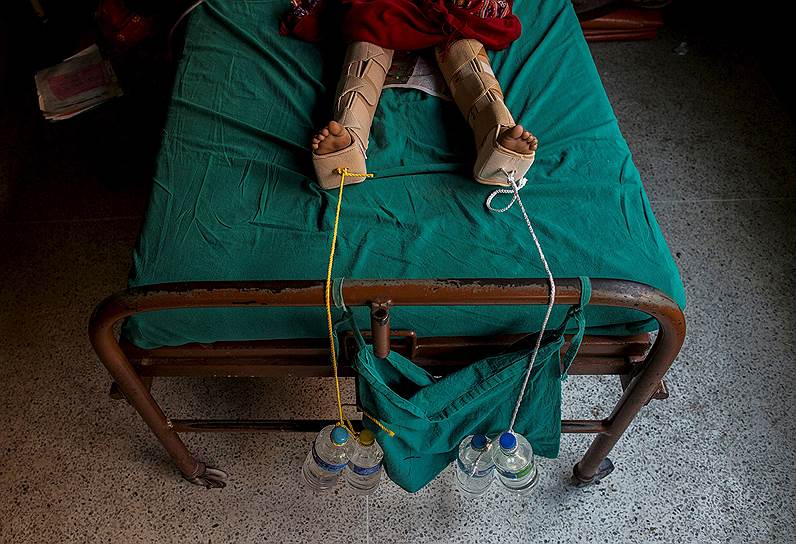 Катманду, Непал. Девушка, сломавшая ноги во время землетрясения, в одном из столичных госпиталей