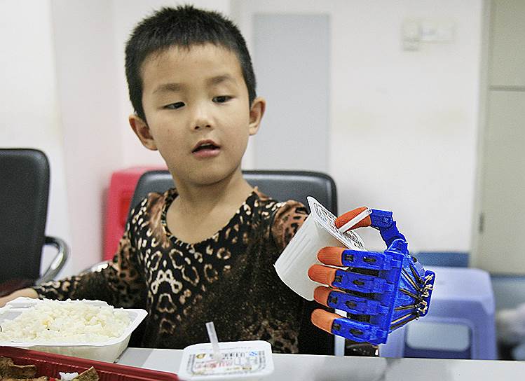 Ухань, Китай. Шестилетний Сяочен тренируется управлять своей новой рукой, изготовленной за 7 часов на 3D-принтере в местной больнице. После нескольких тестов мальчик был способен манипулировать небольшими легкими предметами