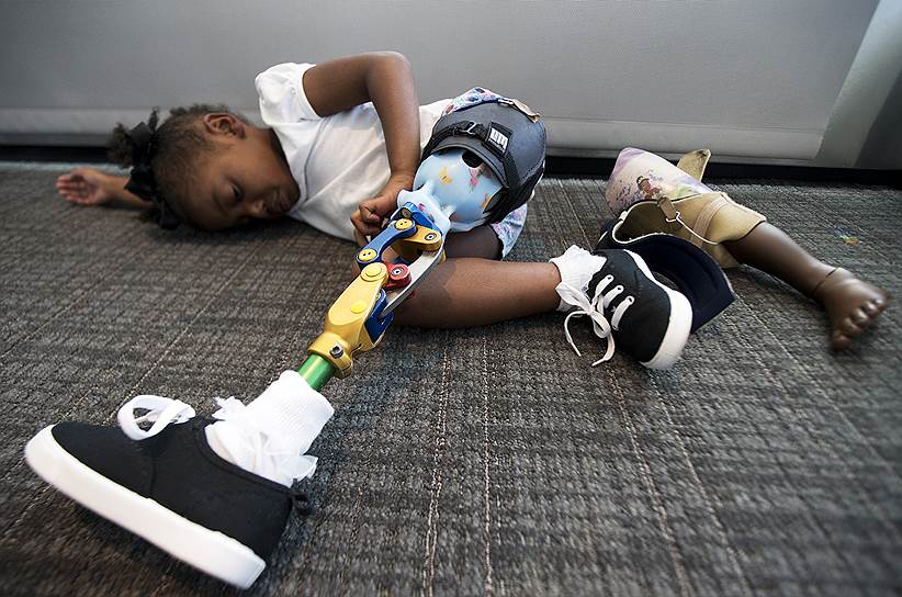 Вашингтон, США. Трехлетняя Мия Уильямс отдыхает после демонстрации нового протеза ноги на конференции Children’s National Health System