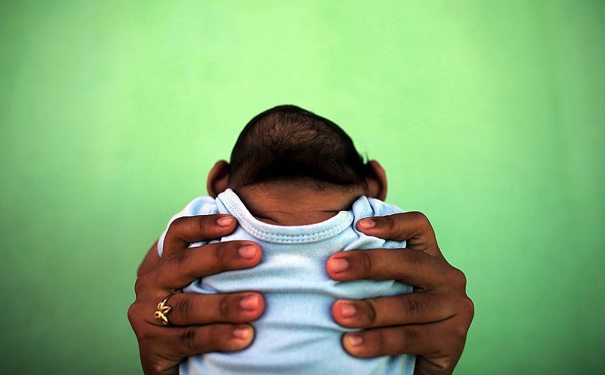 Олинда, Бразилия. Двадцатишестилетняя Жаклин держит на руках своего ребенка, родившегося с микроцефалией из-за вируса Зика