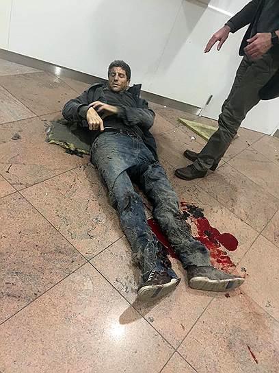 Мужчина, раненый при взрыве в аэропорту