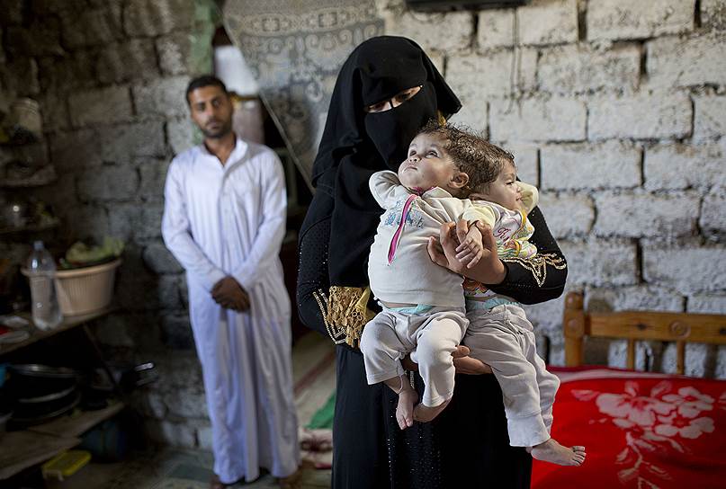 Садат-Сити, Египет. Ислама Хасан и его жена Фатима с 10-месячными сиамскими близнецами на руках