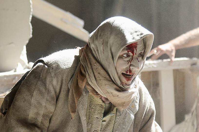 Алеппо, Сирия. Женщина, раненная в результате авиаудара в районе, контролируемом повстанцами