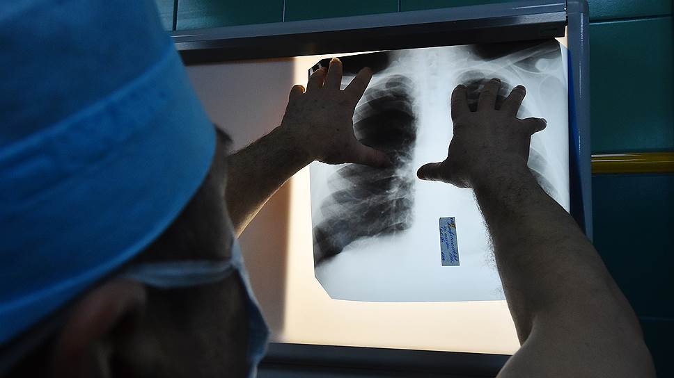 Как рентгенолог стал жертвой рецидивиста