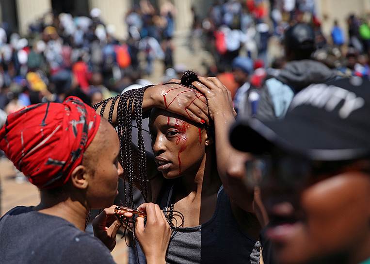 Йоханнесбург, ЮАР. Раненая студентка во время акции, участники которой требуют введения бесплатного высшего образования в стране 