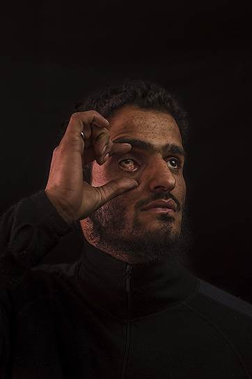 Аамир Ашрам Хаджам был ранен в правый глаз шесть лет назад во время очередного обострения конфликта в Кашмире