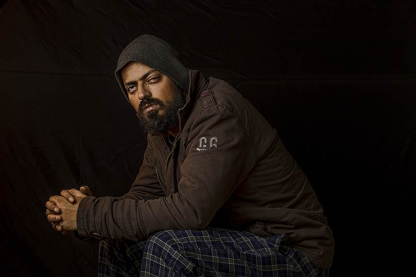 Фотожурналист Зухаиб Макбул получил ранение левого глаза, когда снимал антииндийские протесты в Кашмире. Чтобы объяснить, что он не участник акции, Сухаиб показывал камеру солдату, который выстрелил в него