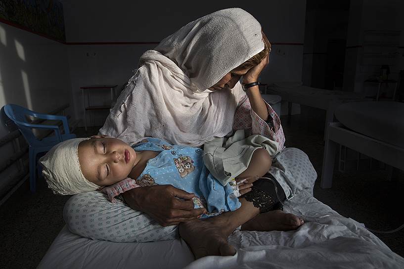 Победитель в номинации «Повседневная жизнь. Одиночный снимок». Женщина держит на руках племянника, раненного во время взрыва в Кабуле (Афганистан) в марте 2016 года