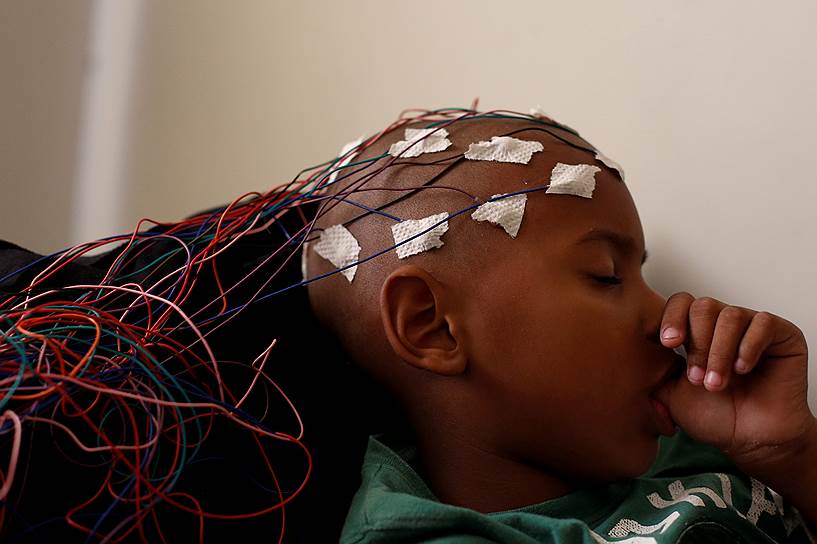 Ла-Гуайра, Венесуэла. 6-летний пациент неврологического отделения во время сеанса электроэнцефалограммы