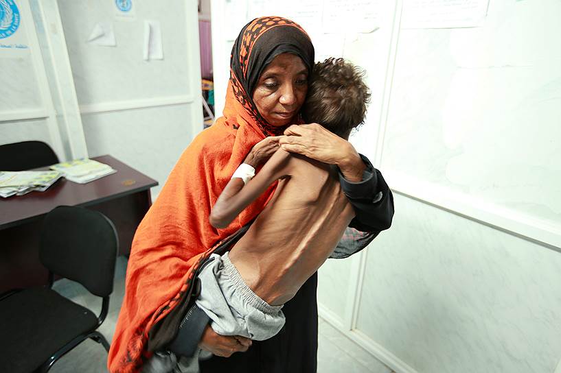 Ходейда, Йемен. Женщина несет 8-летнего сына Имрана, страдающего от недоедания