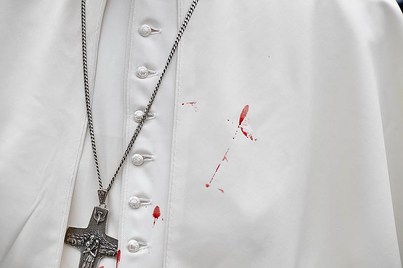 Картахена, Колумбия. Капли крови на тунике папы римского Франциска, рассекшего бровь во время езды в &quot;папамобиле&quot;