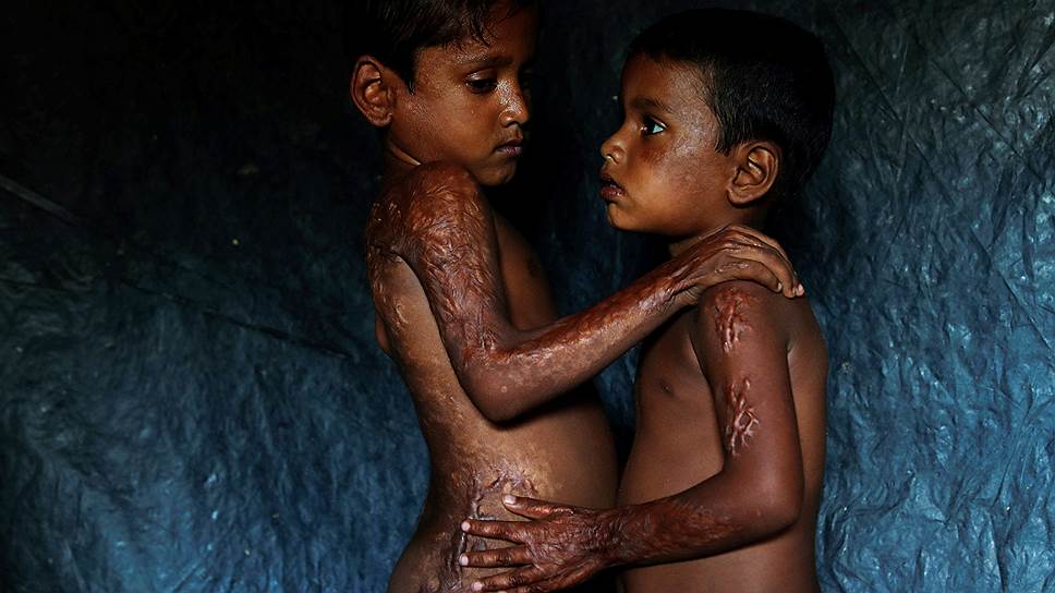 «Врачи без границ» сообщили о гибели почти 7 тыс. мусульман-рохинджа за месяц