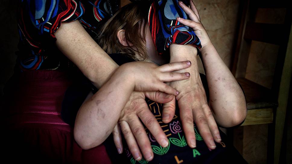 Частный случай насилия: как в Вологде борются за отдельно взятую семью