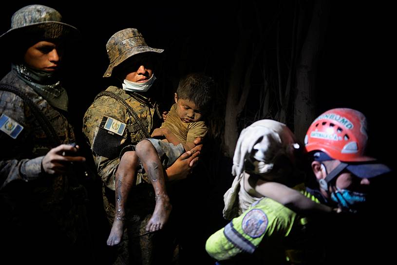 Шестеро детей, получивших сильных ожоги в результате извержения вулкана, 6 июня вылетели спецбортом в США на лечение