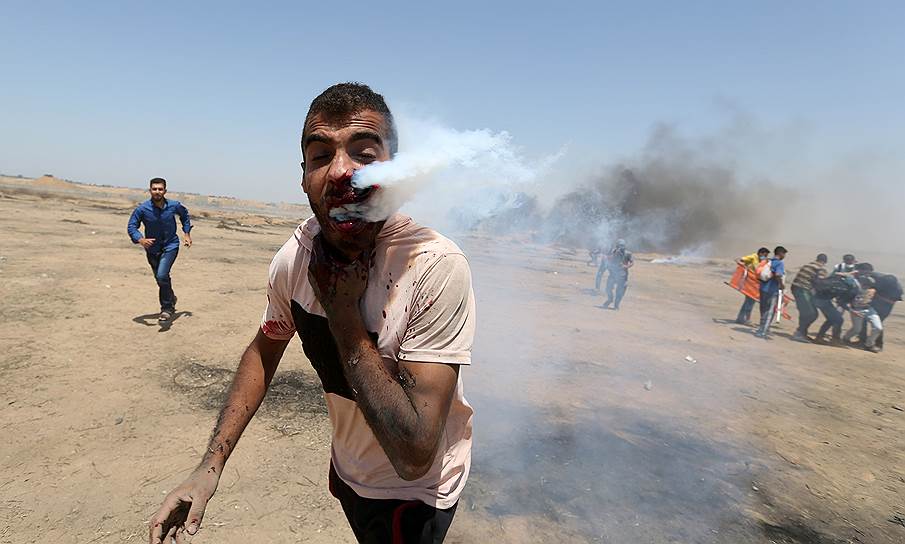 Сектор Газа. Раненый палестинский протестующий 