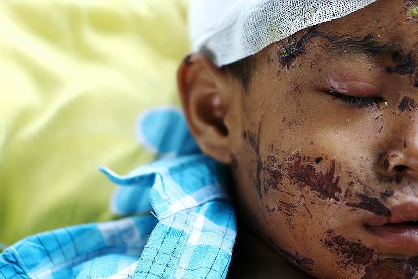 Палу, Индонезия. Пострадавший в результате землетрясения проходит обследование в больнице  
