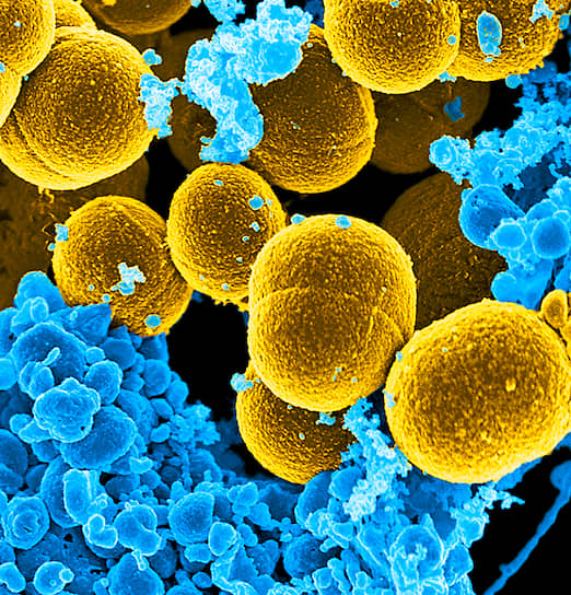 Золотистый стафилококк. Бактерия может вызвать воспалительный процесс практически в любом органе