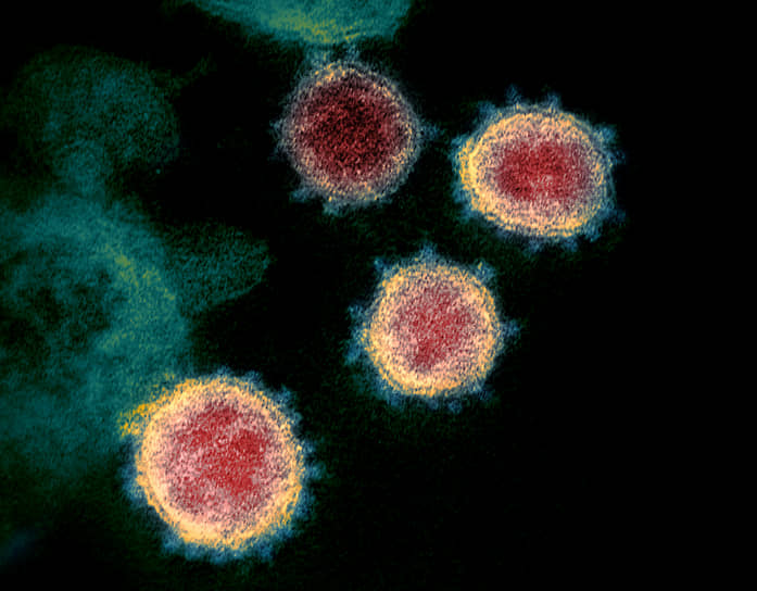 Частицы SARS-CoV-2 покрыты «шипами», похожими на солнечную корону, из-за которых вирус и получил свое название
