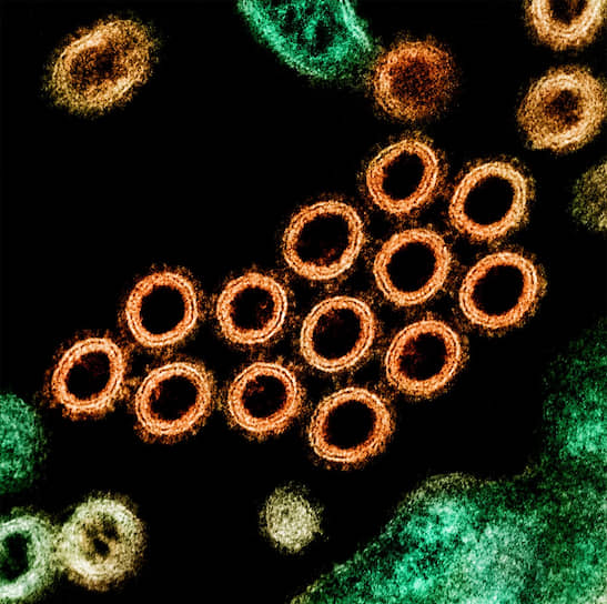 Частицы вируса свиного гриппа 