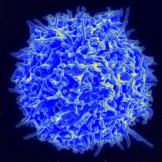 T-лимфоциты — лейкоциты, вырабатываемые в костном мозге