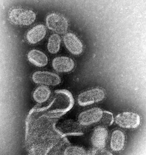 Найти универсальную вакцину против гриппа мешает постоянная изменчивость вируса 