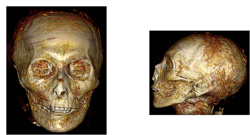 Мумию фараона Аменхотепа I просканировали и узнали о нем много нового