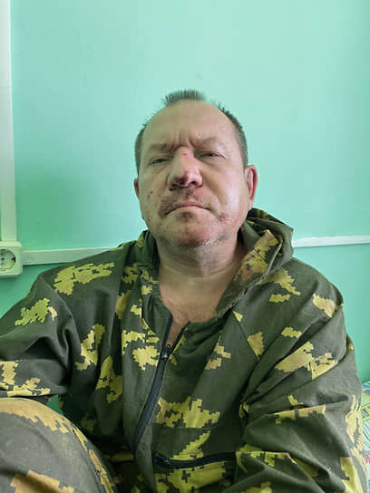 Игорь Каляпин после нападения