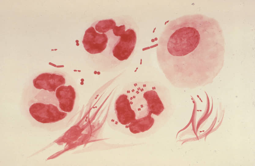 Гонокок Neisseria gonorrhoeae является возбудителем гонореи. При этом этот микроб лучше всех приспособился к современным методам лечения