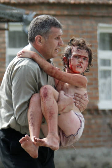 Девочка, раненая во время захвата школы в Беслане в сентябре 2004 года