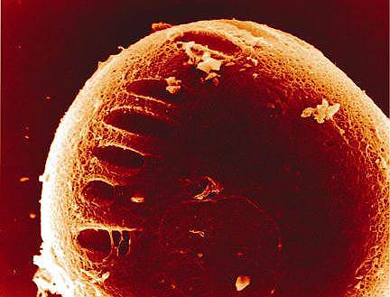 Микрофотография защитной оболочки эмбриона после воздействия миллисекундным лазером, электронная микроскопия 
