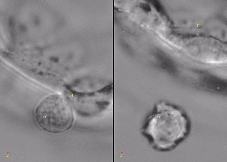 Биопсия трофэктодермы (поверхностного слоя клеток эмбриона) на стадии бластоцисты (на пятый день после оплодотворения). Слева участок блестящей оболочки на стадии хэтчинга, справа отсеченная часть трофэктодермы, захваченная оптическим пинцетом 
