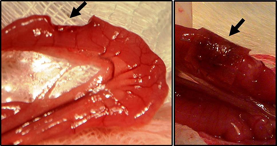 Регенерация стенки тощей кишки крысы с помощью &quot;заплатки&quot; из фиброинового каркаса, витализированного стволовыми клетками костного мозга. Слева -- кишечник с удаленным овальным фрагментом. Справа -- овальное отверстие закрыто фиброиновым имплантатом, который через три недели разрушается, и на его месте формируется полноценная стенка кишечника 